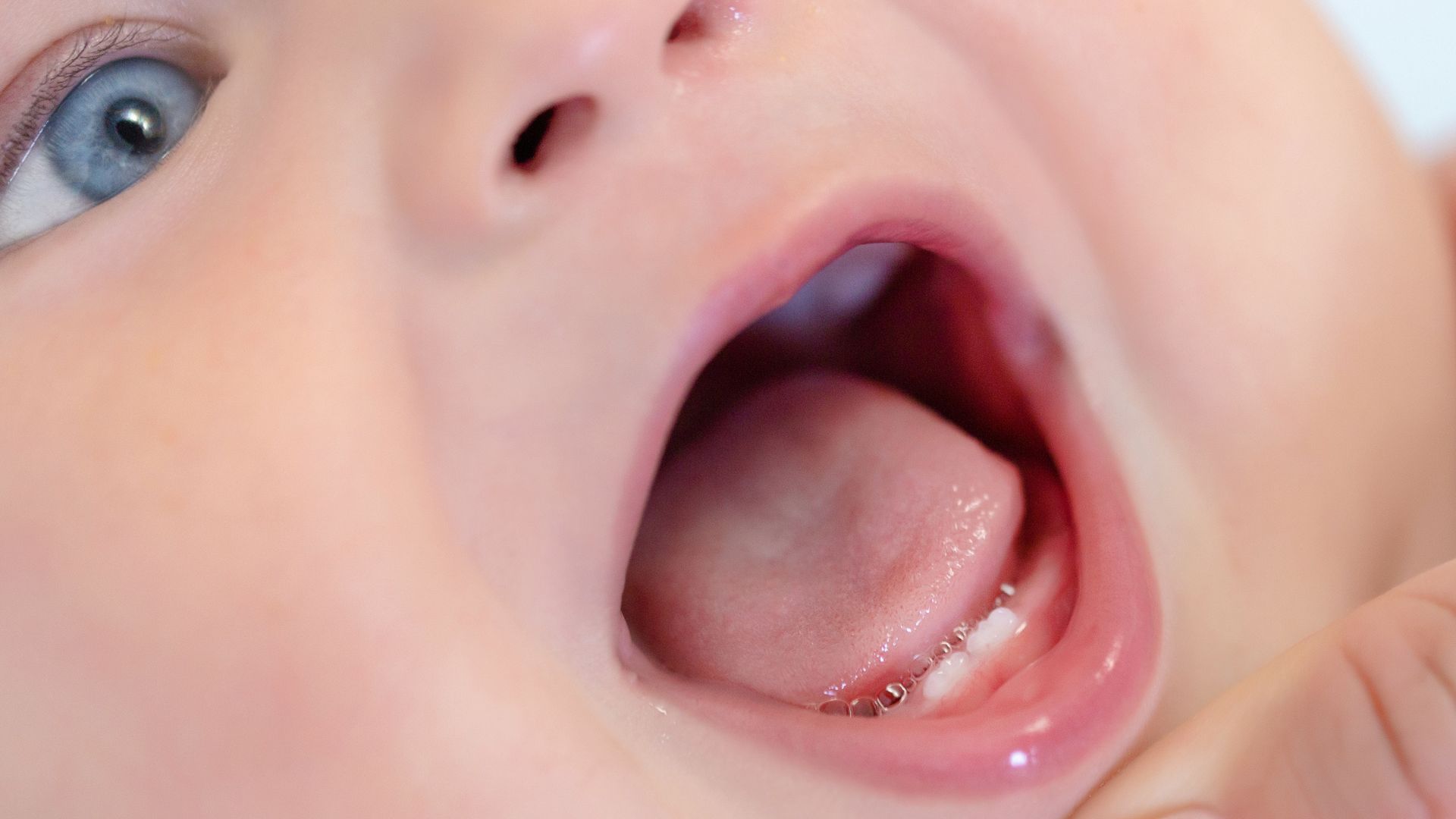 Bebé abriendo la boca con una llaga en la lengua