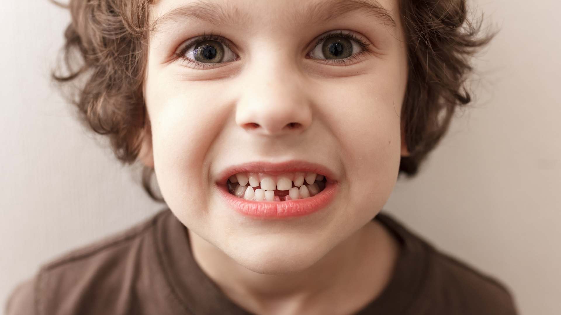 niño enseñando su sonrisa con un espacio entre los dientes